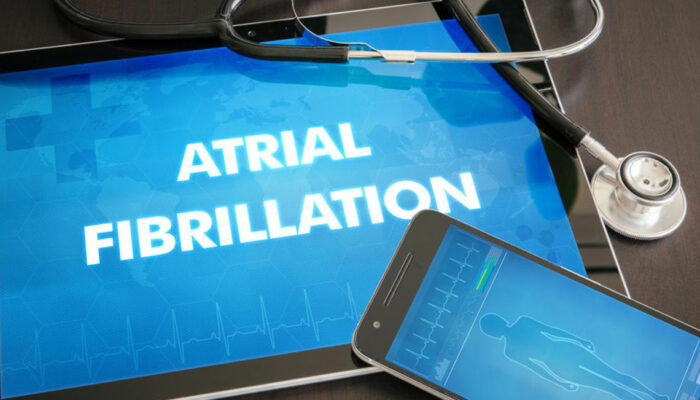 Atrial Fibrillation Treatment Options That Can Save Your Heart and Life