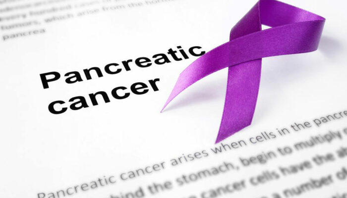 Basic Facts You Should Know On Treatment Of Stage 4 Pancreatic Cancer