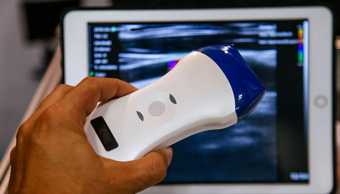 Benefits of portable ultrasound machines