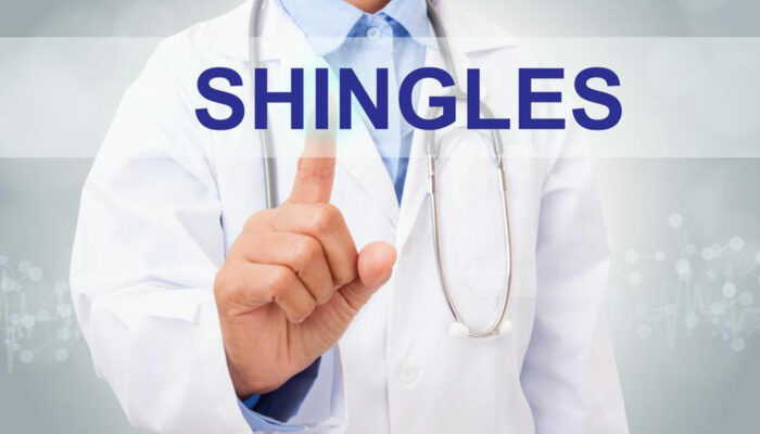 Best Treatment For Shingles Using Shingle Relief Creams