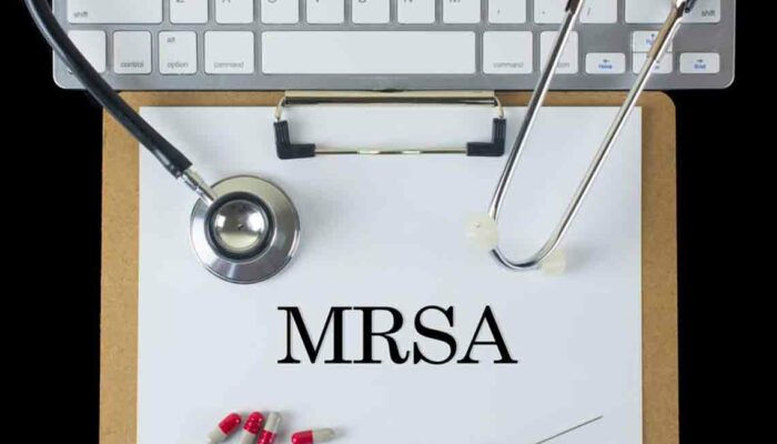 Causes, Symptoms and Treatment for MRSA