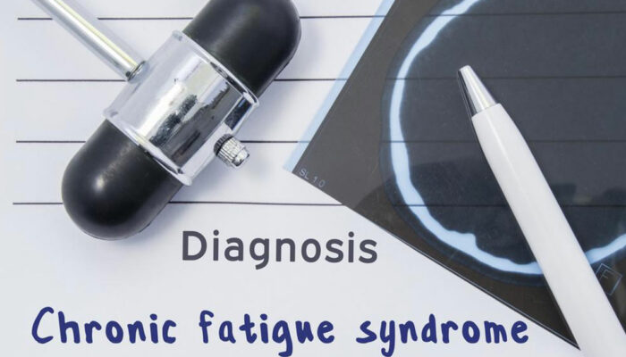 Causes, Symptoms, and Treatments for Chronic Fatigue Syndrome