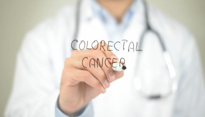 Causes and Diagnosis of Colorectal Cancer