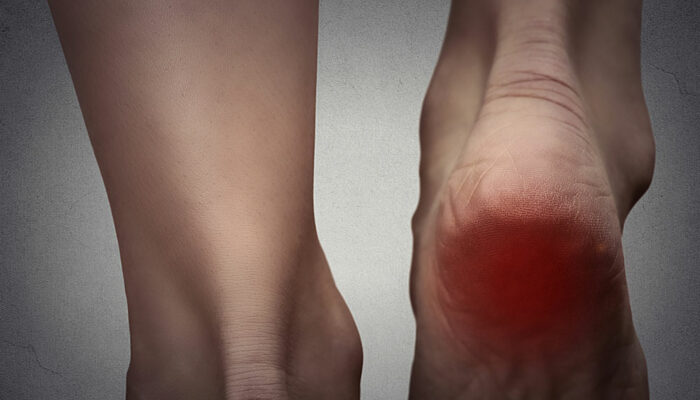 Causes and Symptoms of Pain in the Foot