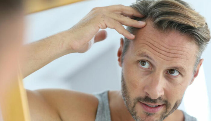 Causes and remedies of hair loss