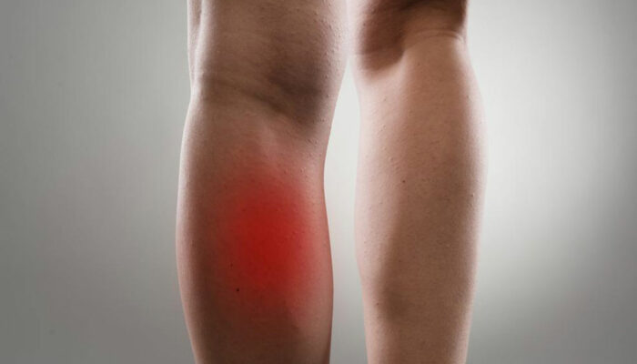 Common Causes and Treatments of Leg Muscle Pain