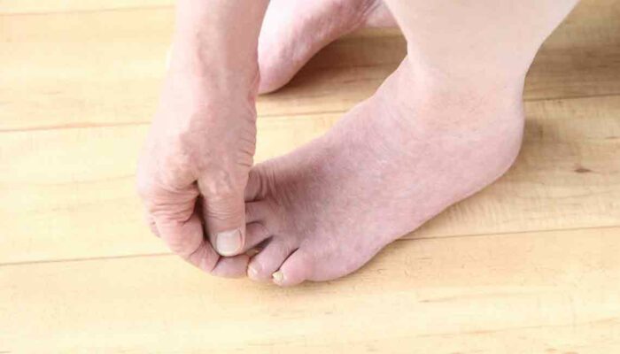 Common Diabetic Feet problems and Its Preventive Measures