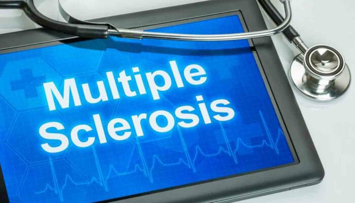 Common Multiple Sclerosis Symptoms You Should Be Aware Of