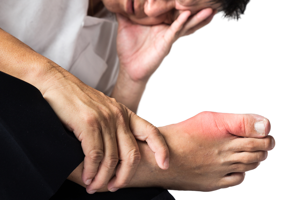 Common Risks and Causes of Gout