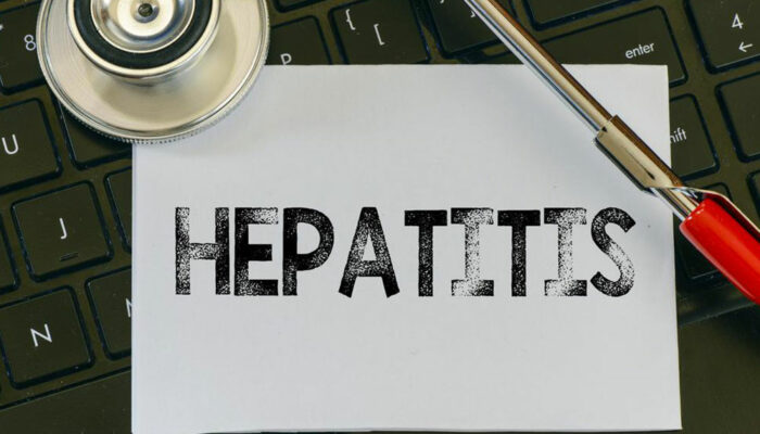 Common Symptoms of Hepatitis C