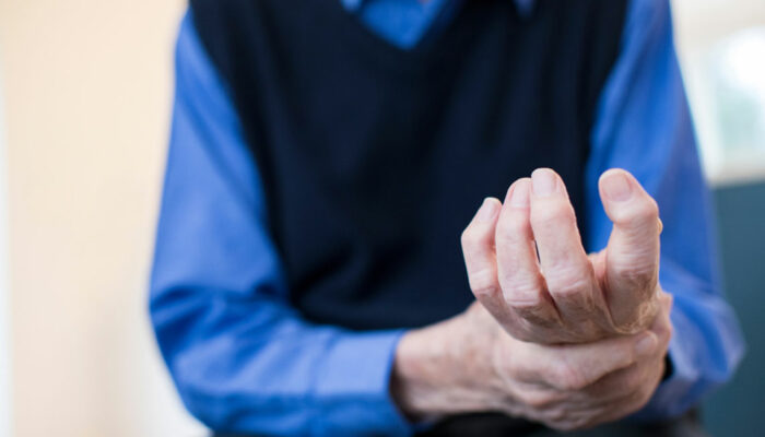 Common symptoms of rheumatoid arthritis