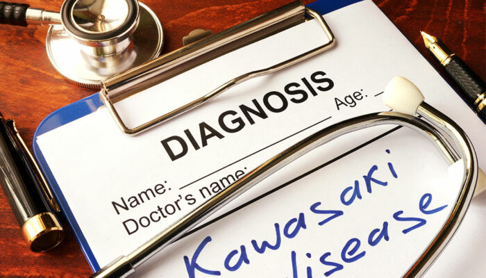 Diagnosis and treatment of Kawasaki disease