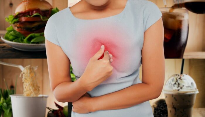 Diet And Lifestyle Changes To Help Deal With Acid Reflux