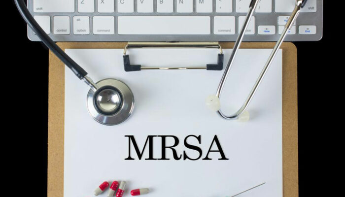 Different Ways to Treat MRSA