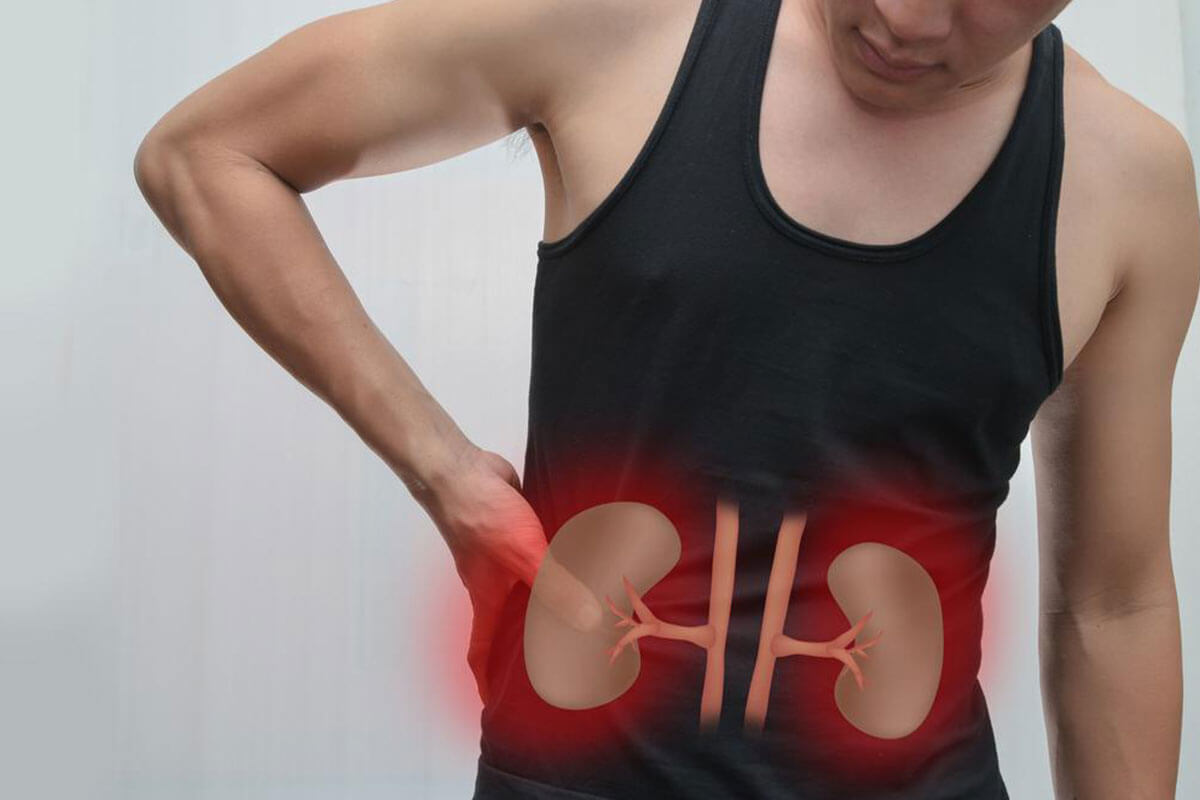 Do Not Ignore These Kidney Cancer Symptoms