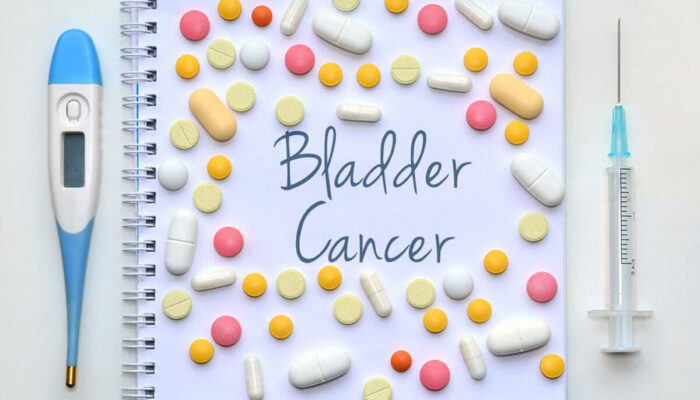 Do You Have Any of These Bladder Cancer Symptoms?