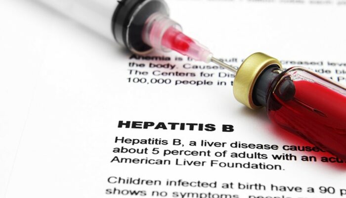 Do You Have These Hepatitis B Symptoms