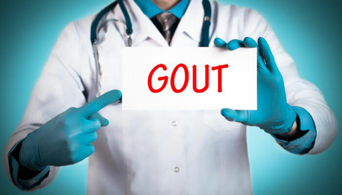 Easy Gout Remedies to Help Manage Pain