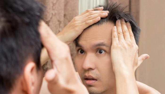 Effective Hair Loss Treatments for Thinning Hair