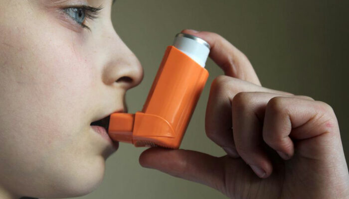 Effective Tips to Treat Asthma