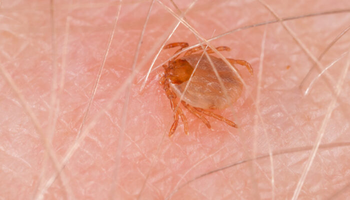 Effective Treatment Methods for Tick-borne Illness