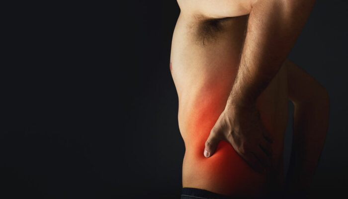 Effective Treatment Options for Sciatic Nerve Pain