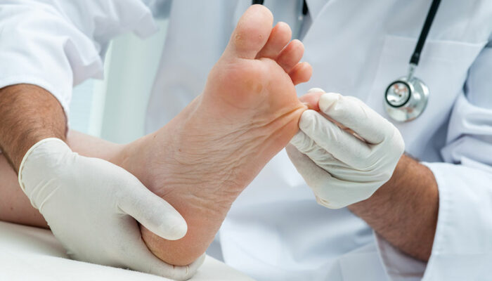 Effective Treatments for Toenail Fungus