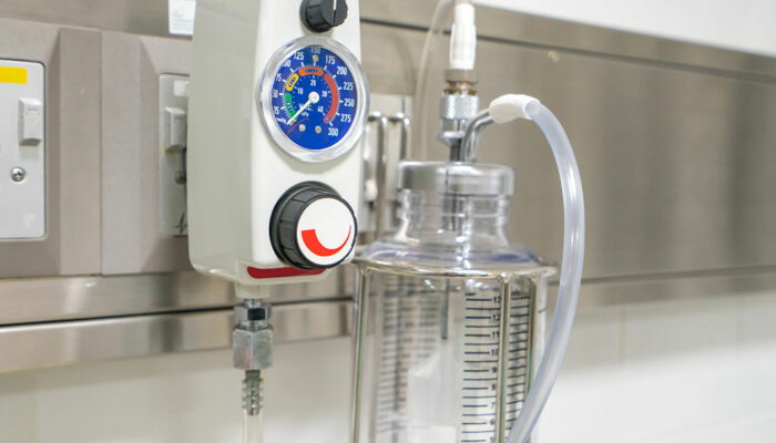 Essential things you need to know about oxygen concentrators