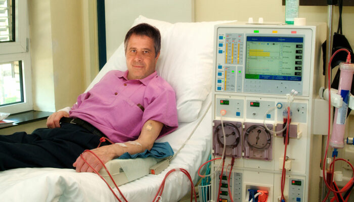 Essential Things to Know about Kidney Dialysis