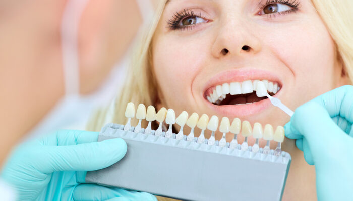 Everything You Need To Know About Dental Implants