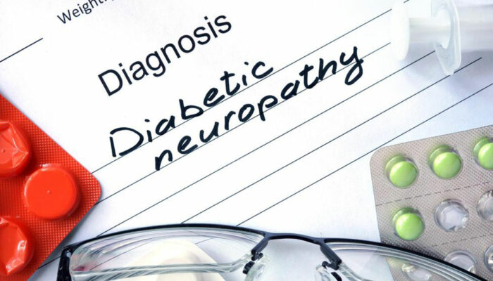 Everything You Need to Know about Diabetic Neuropathy