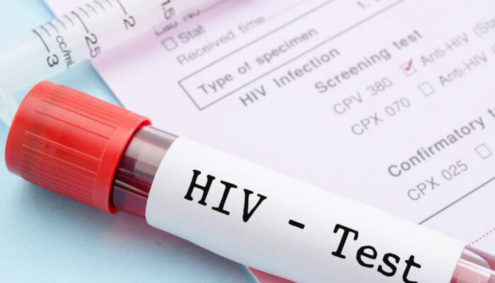 Everything you need to know about HIV and AIDS