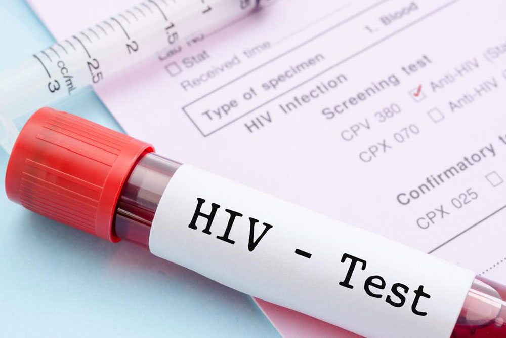 Everything you need to know about HIV and AIDS