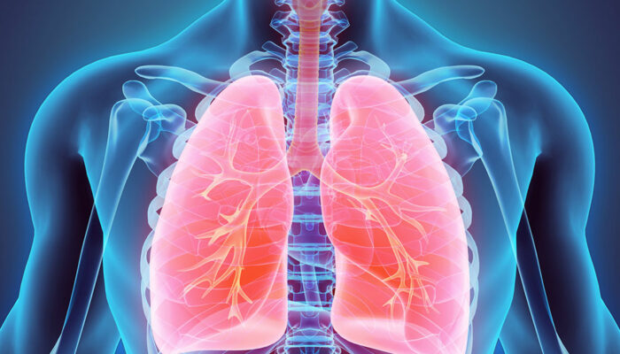 Everything you should know about lung cancer