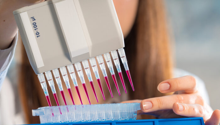 Factors To Consider While Choosing A Dna Testing Kit