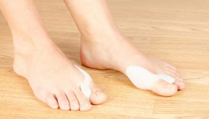 Find Relief in the Right Kind of Shoes for Bunions