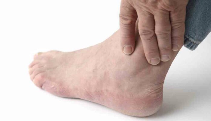 Find relief with these 5 home remedies for foot pain