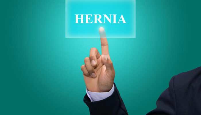 Find the Best Hernia Treatment for You