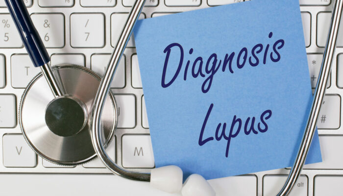 First Symptoms of Lupus to Watch Out For