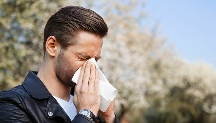 Frequently asked questions about allergies