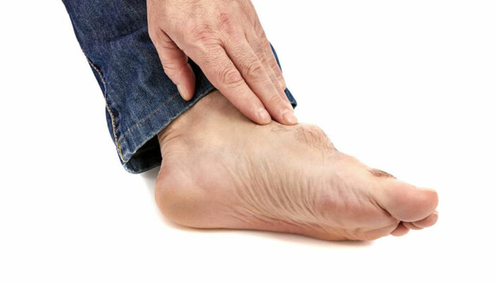 Gout &#8211; Causes, Symptoms, Treatment, and Diet Plans