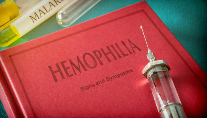 Hemophilia &#8211; 4 main symptoms and their severity