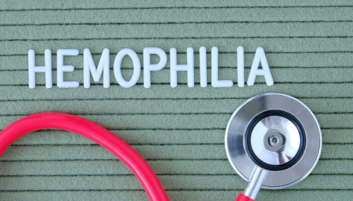 Hemophilia &#8211; Early signs and ways to manage the condition