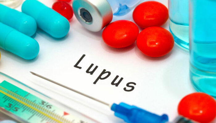 Here Are the 8 Early Signs of Lupus