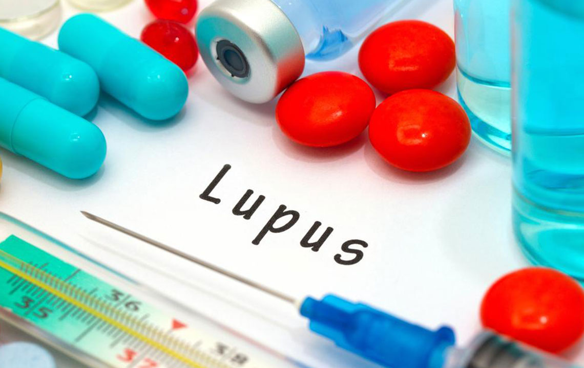 Here Are the 8 Early Signs of Lupus