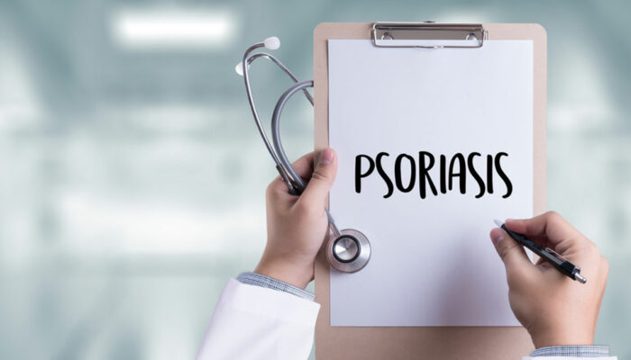 Here are Some Treatment Options for Psoriasis