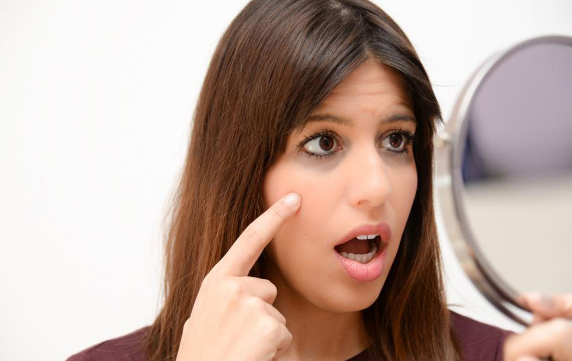 Here&#8217;s How to Fix Your Dark Circles Like a Pro