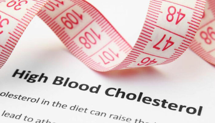 High Cholesterol &#8211; Symptoms and Treatment Options