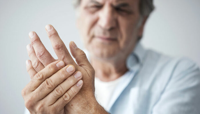 Home Remedies to Treat Rheumatoid Arthritis