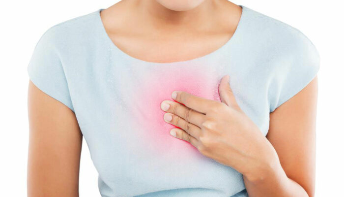 How to Treat and Prevent Heartburn and Indigestion